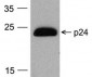 HIV-1 p24 Antibody [7F4] (HRP)