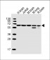 PPP2R1B Antibody