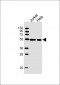 XIAP Antibody