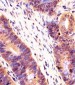 PSMB7 Antibody (Center)