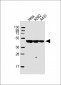 CYK18 Antibody (C-term)