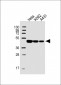 CYK18 Antibody (C-term)