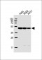 CYK18 Antibody (C-term)