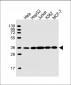 HNRNPA1L2 Antibody (N-Term)