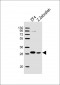 Zebrafish ak2 Antibody (N-term)