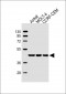 ADA Antibody (C-term)