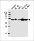 NDUFV1 Antibody (Center)