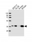 ALDOC Antibody (C-term)