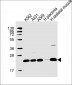 UQCRFS1P1 Antibody (Center)