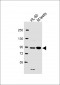 ENASE Antibody  (Center)
