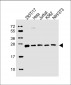 PSMB3 Antibody (Center)