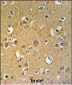 TUBB2C Antibody (Center)