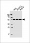 TUBB2C Antibody (Center)