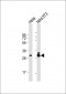 TPM3 Antibody