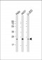 RAB1B Antibody