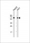 TERF2IP Antibody