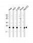 RAB1B Antibody