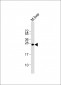 IGF2 Antibody (Center R54)