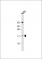 LSM7 Antibody (C-term)