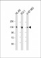 DEPD5 Antibody (C-term)