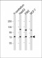 SMPD1 Antibody (C-term)