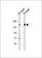 MYBPC3 Antibody (N-term)