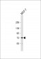 PIAS2 (PIASx1/2) Antibody (N-term)
