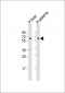 PROC Antibody (Center)