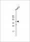 LDB2 Antibody (C-term)