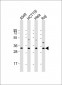 CD274 Antibody (C-term)