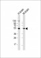 ESR2 Antibody(Center)