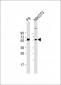 ESR2 Antibody(Center)