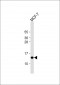 SH3BGRL Antibody (Center)