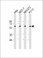 TP53 Antibody (N-term)