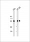 TP53 Antibody (N-term)