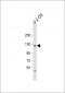 LIFR Antibody (C-term)
