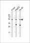 BAAT Antibody (N-Term)