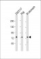 PLA2G4F Antibody (Center)