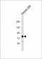 ALK Antibody (C-term)