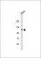 SEC24D Antibody (N-Term)