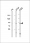 NUP93 Antibody (N-Term)