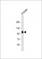 ADAMTS17 Antibody (N-term)