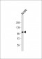 ADAMTS17 Antibody (N-term)