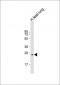 PRTN3 Antibody (C-term)