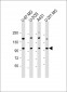 THSD1 Antibody (C-Term)