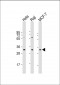 APIP Antibody (Center)