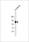 ITIH4 Antibody (C-Term)