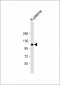 ITIH4 Antibody (C-Term)