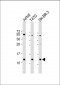 TFF1 Antibody (Center)