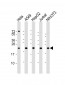 RPS7 Antibody (N-Term)